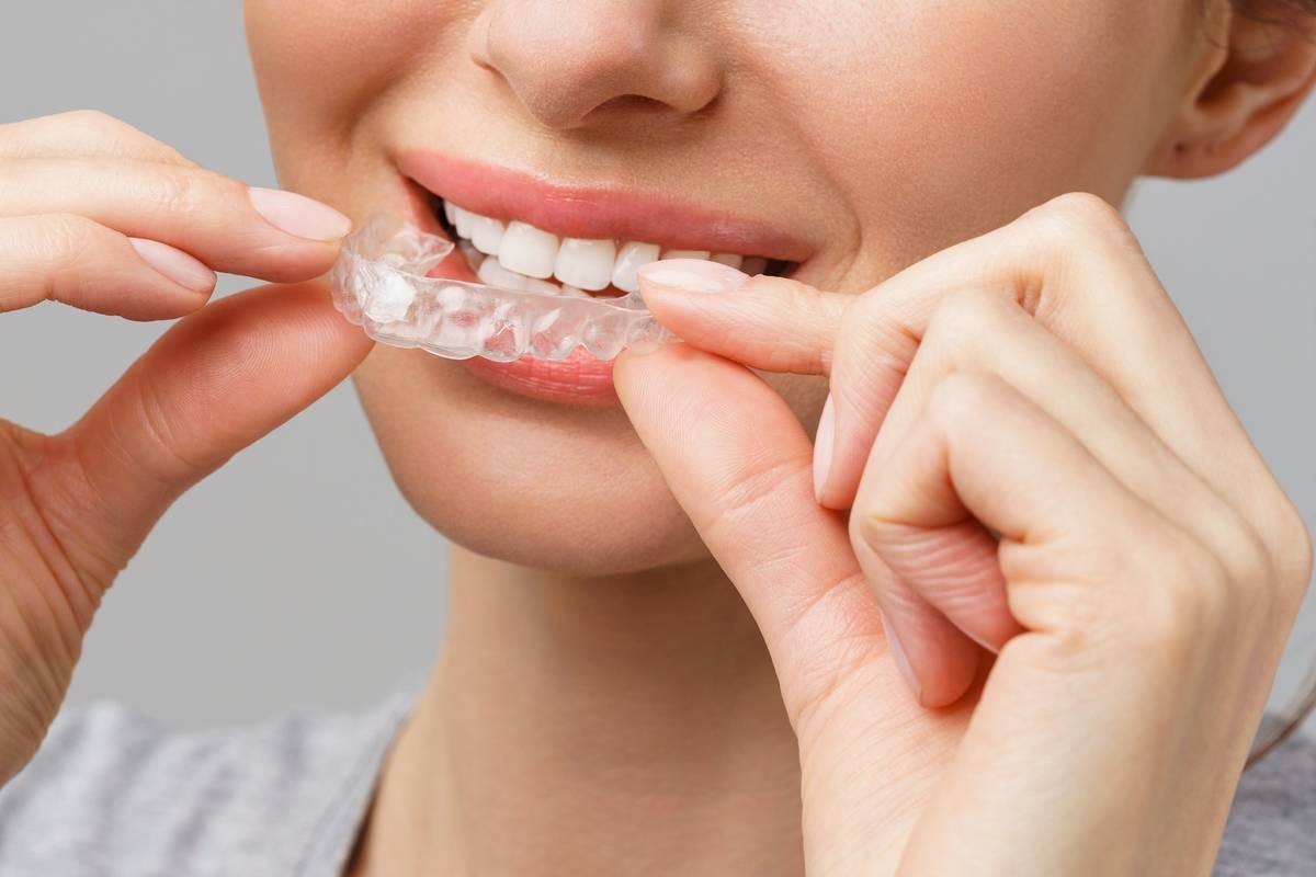 Teeth Whitening Specialist